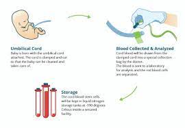 Cord Blood Banking: Preserving Health and Happiness